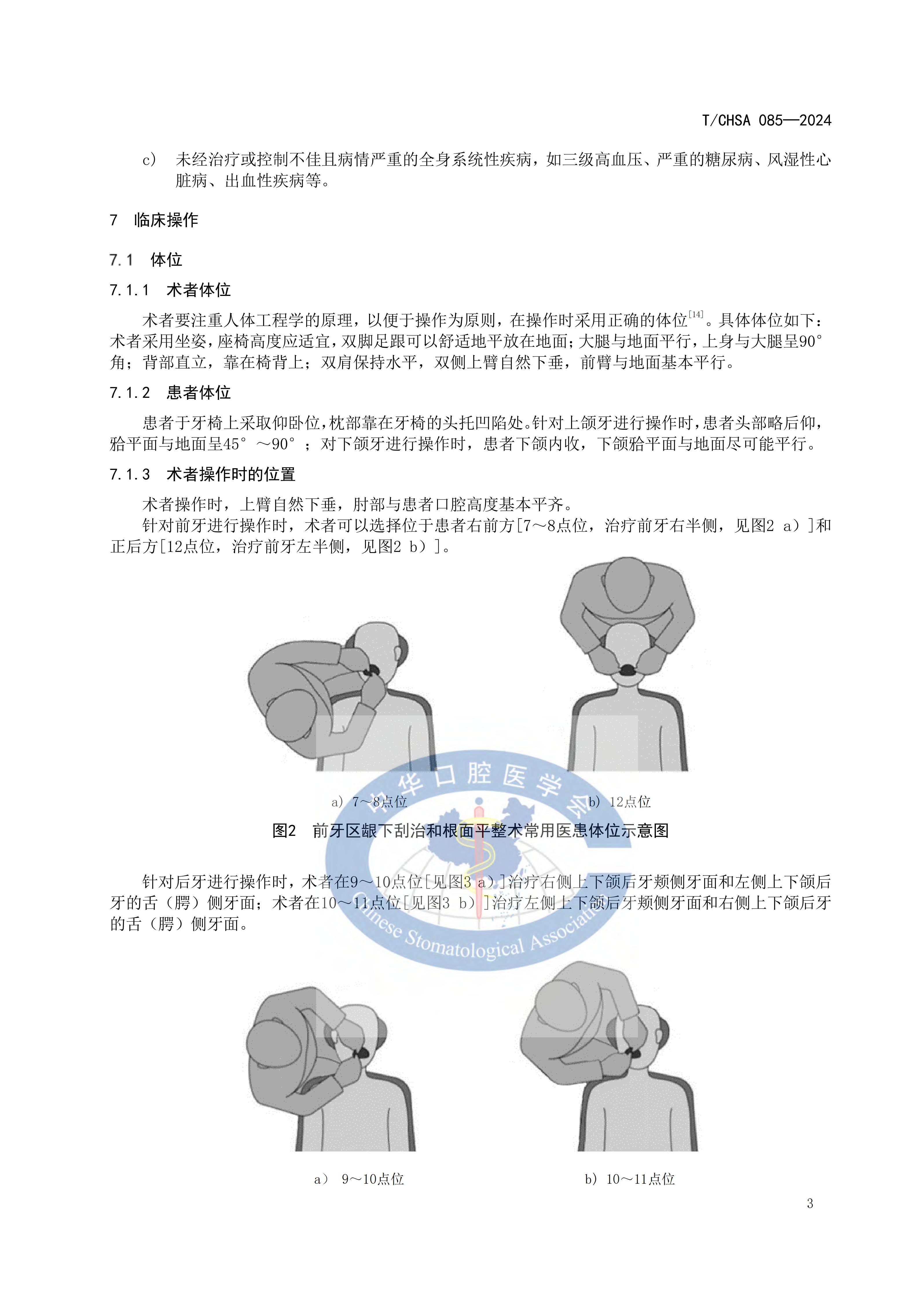 85-牙周龈下刮治和根面平整术操作规范_06.jpg